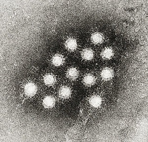 A型肝炎ウイルス