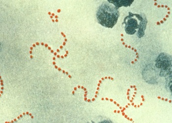 化膿レンサ球菌