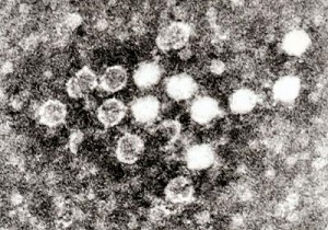 血液中のパルボウイルス-電子顕微鏡写真